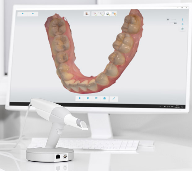 Plano 3D Cone Beam and 3D Dental Scans