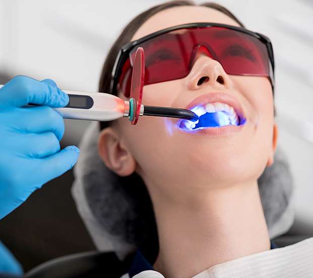 Plano Professional Teeth Whitening